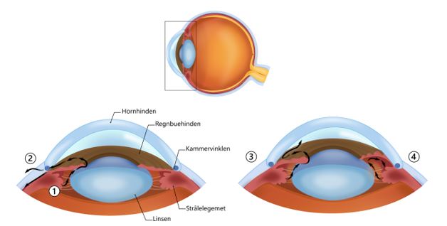Illustrationer af Zaynab Ahmad Mouhammad, medicinstuderende p&aring; K&oslash;benhavns Universitet