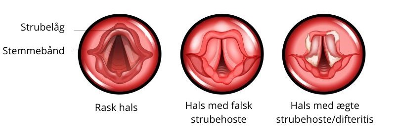 Falsk strubehoste