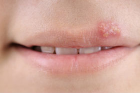 Fork&oslash;lelsess&aring;r